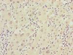 FBXO22 Antibody in Immunohistochemistry (Paraffin) (IHC (P))