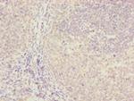 FBXO22 Polyclonal Antibody