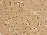 CPT1C Polyclonal Antibody