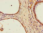 SPPL2A Antibody in Immunohistochemistry (Paraffin) (IHC (P))