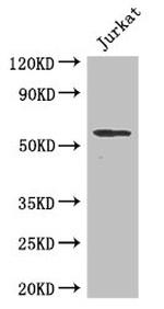 SPPL2A Antibody in Western Blot (WB)