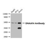 DYX1C1 Antibody in Western Blot (WB)