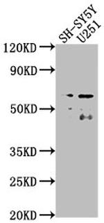 TAIP2 Polyclonal Antibody