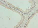 Cytokeratin 35 Polyclonal Antibody