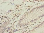 GFM2 Antibody in Immunohistochemistry (Paraffin) (IHC (P))