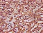 RCN3 Antibody in Immunohistochemistry (Paraffin) (IHC (P))