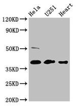 RCN3 Antibody in Western Blot (WB)