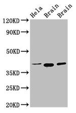 ERGIC2 Antibody in Western Blot (WB)