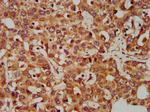 CLCC1 Antibody in Immunohistochemistry (Paraffin) (IHC (P))