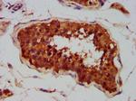 CLCC1 Antibody in Immunohistochemistry (Paraffin) (IHC (P))