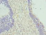 Cytohesin 2 Polyclonal Antibody