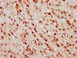 TSNAX Antibody in Immunohistochemistry (Paraffin) (IHC (P))