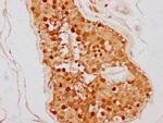 TSNAX Antibody in Immunohistochemistry (Paraffin) (IHC (P))