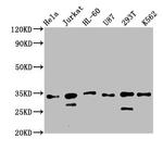 TSNAX Antibody in Western Blot (WB)