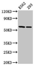 TCP-1 eta Antibody in Western Blot (WB)