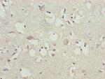 GAS2L1 Antibody in Immunohistochemistry (Paraffin) (IHC (P))