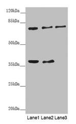 GAS2L1 Antibody in Western Blot (WB)