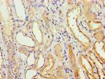 AGPAT1 Antibody in Immunohistochemistry (Paraffin) (IHC (P))