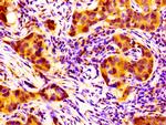 NPAS2 Antibody in Immunohistochemistry (Paraffin) (IHC (P))