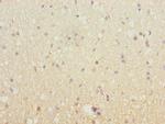 SH3GL2 Polyclonal Antibody