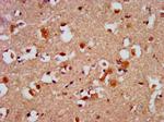 CAPS2 Antibody in Immunohistochemistry (Paraffin) (IHC (P))