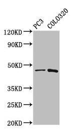 CAPS2 Antibody in Western Blot (WB)