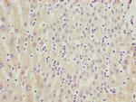 CYP3A43 Polyclonal Antibody