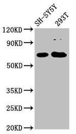 GALNT9 Polyclonal Antibody