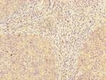 ADAT1 Antibody in Immunohistochemistry (Paraffin) (IHC (P))