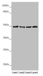 AP1M1 Antibody in Western Blot (WB)