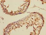 TAIP12 Antibody in Immunohistochemistry (Paraffin) (IHC (P))