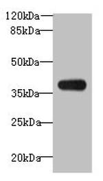 ASB7 Antibody in Western Blot (WB)