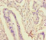 TDRD3 Polyclonal Antibody