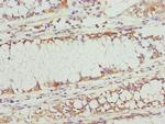 TAPP1 Antibody in Immunohistochemistry (Paraffin) (IHC (P))