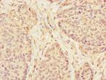 KLHL13 Antibody in Immunohistochemistry (Paraffin) (IHC (P))