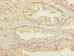 KLHL13 Polyclonal Antibody