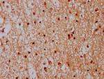 CPNE7 Antibody in Immunohistochemistry (Paraffin) (IHC (P))