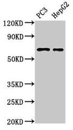 PARP2 Antibody in Western Blot (WB)