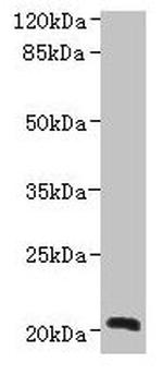 NICN1 Antibody in Western Blot (WB)