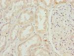 SKIP Polyclonal Antibody