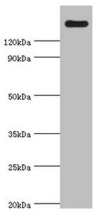 CARD11 Polyclonal Antibody