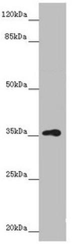 GNB1L Polyclonal Antibody