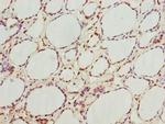 GNB1L Polyclonal Antibody