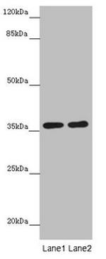 GNB1L Antibody in Western Blot (WB)