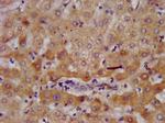 AGXT2 Antibody in Immunohistochemistry (Paraffin) (IHC (P))