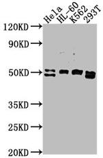 DDX47 Polyclonal Antibody