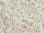 MCCC2 Polyclonal Antibody
