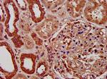 PIGV Antibody in Immunohistochemistry (Paraffin) (IHC (P))