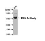 PIGV Antibody in Western Blot (WB)