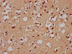 GRHL1 Antibody in Immunohistochemistry (Paraffin) (IHC (P))